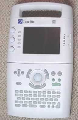 SonoSite 180